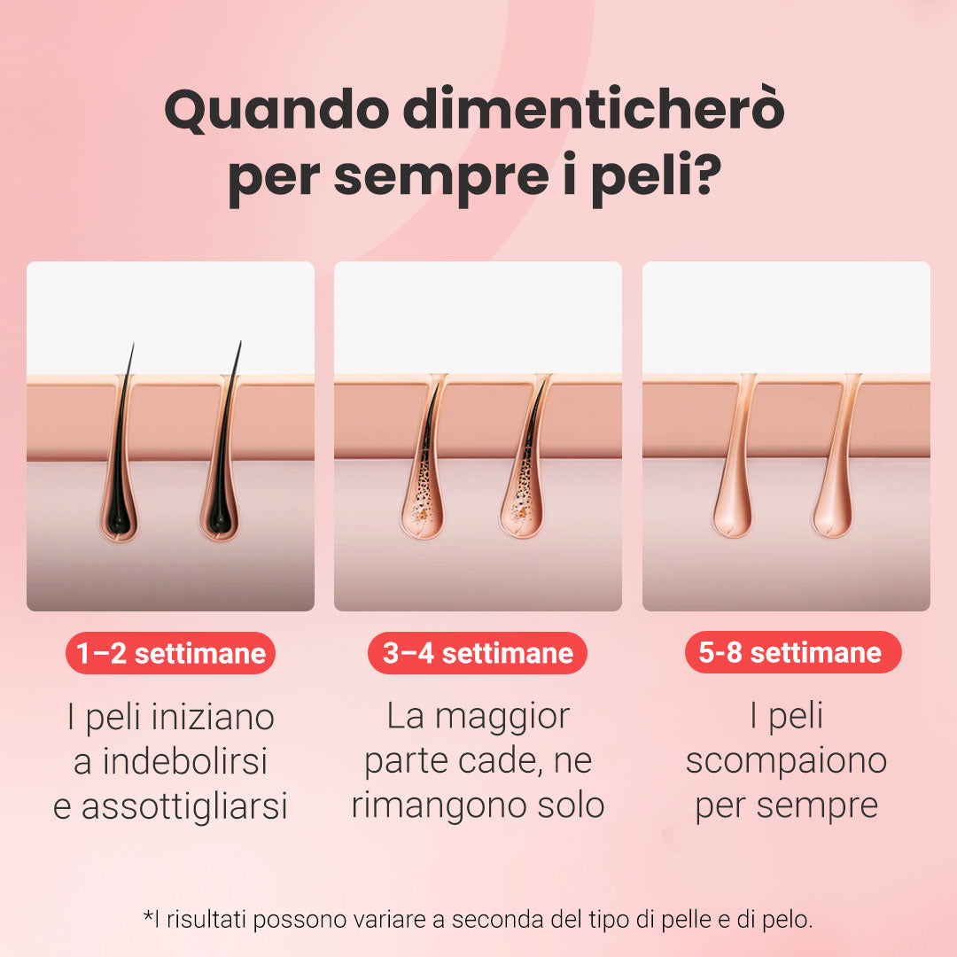 Fotoepilatore a luce pulsata