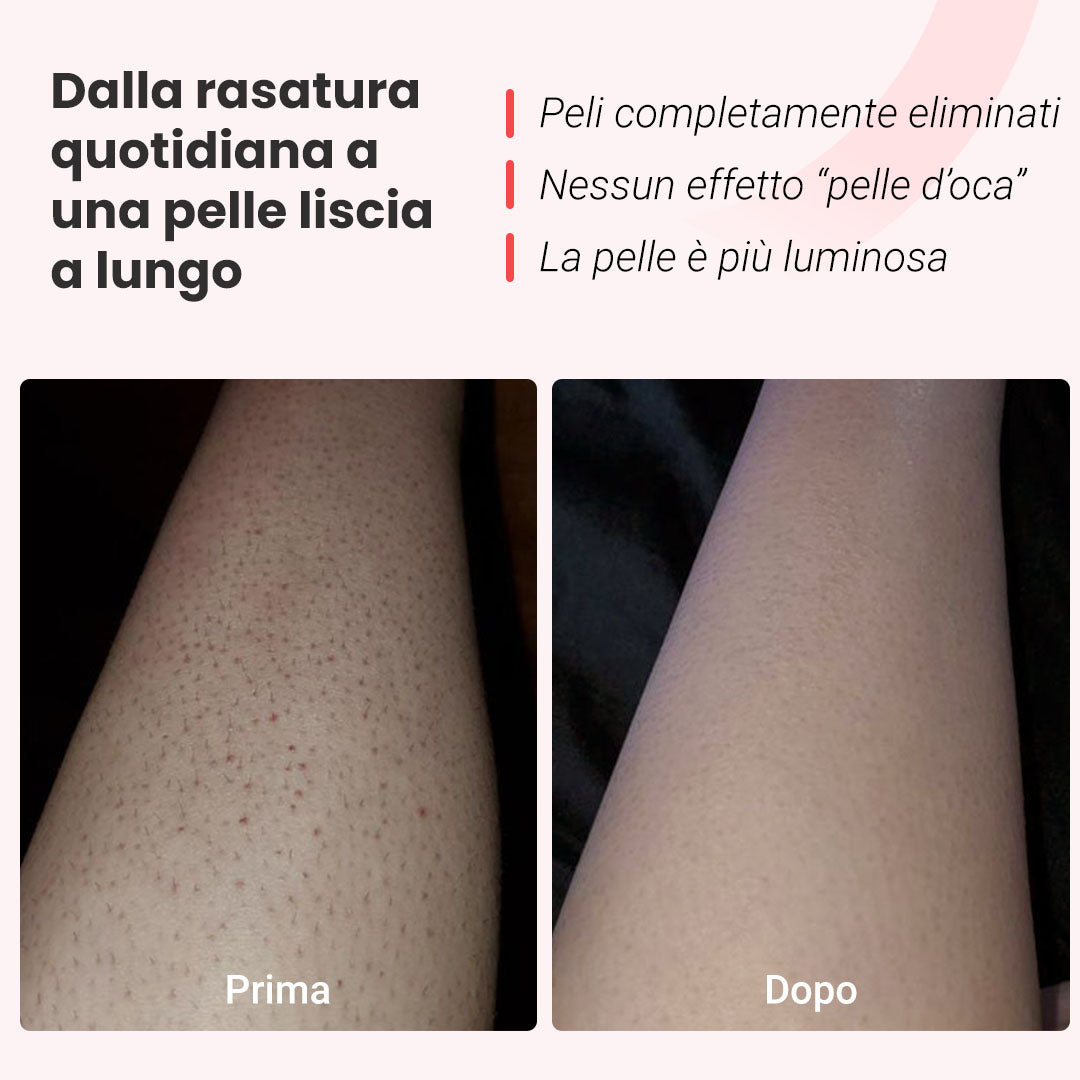 Fotoepilatore a luce pulsata